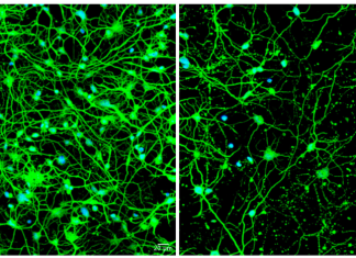 Cellular housekeeping process implicated in fatal neurological disorder