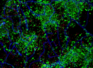 Infections can have long-term consequences