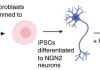 Stem cell study reveals how neurons from PTSD patients react to stress