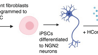 Stem cell study reveals how neurons from PTSD patients react to stress