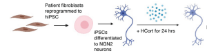 Stem Cell Study Shows How Neurons from PTSD Patients React to Stress