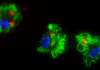 Toxoplasma Parasite Persuades Immune Cell to Change Behavior, Aiding Dissemination