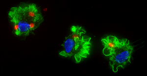 Toxoplasma Parasite Persuades Immune Cell to Change Behavior, Aiding Dissemination