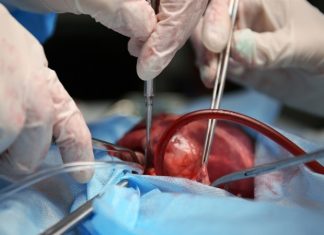 New method can protect organs during heart and aortic surgery