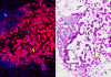 NIH grant funds cancer prevention vaccine research