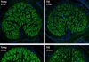 Retinal Aging Accelerated by Stress
