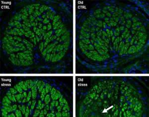 Retinal Aging Accelerated by Stress