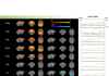 Scientists optimize methods to study brains at rest in a key model organism
