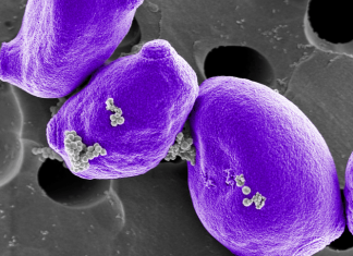 Accelerating pathogen identification in infants and children with bloodstream infections