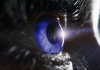 BRIM Biotechnology receives FDA orphan drug designation for treatment of neurotrophic keratitis – Ophthalmology Times