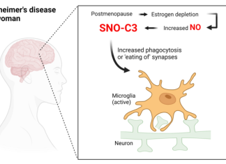 Higher Alzheimer’s Incidence in Women Linked to Modified Immune System Protein