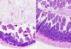 Intestinal Inflammation Reversed in Mice Using Drug to Target “Reset Switch”