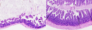 Intestinal Inflammation Reversed in Mice Using Drug to Target “Reset Switch”