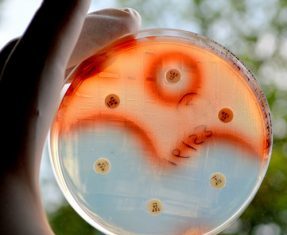 MRSA and TB Thwarted by Synthesized Natural Antibacterial Analogs