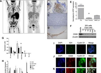Oncotarget | Combined epigenetic and immunotherapy for blastic and classical mantle cell lymphoma