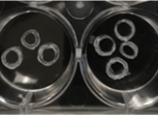 Study: New customizable, strontium-filled scaffold could improve dental implant healing