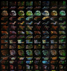 3D Spatial Colorectal Cancer Maps Combine Molecular and Histological Features