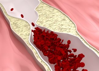 Adipose-targeted delivery of thyroid hormone alleviates hypercholesterolemia and atherosclerosis