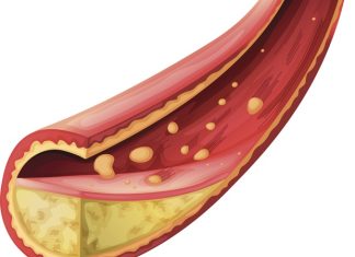 Combined glucocorticoid steroids and statin therapy may be safer for the treatment of preterm birth