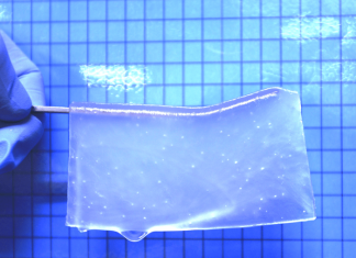 Healing the brain: Hydrogels enable neuronal tissue growth