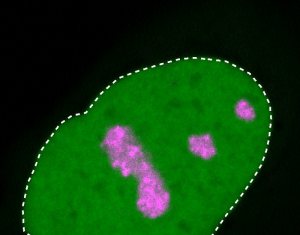 Mutant Proteins Gum Up Nucleolus, Cause Rare Genetic Disease