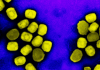 NIH scientists develop mouse model to study mpox virulence