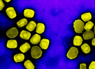 NIH scientists develop mouse model to study mpox virulence