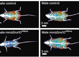 Obesity Linked Jumping Genes Maneuver Metabolic Health