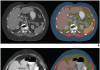 Technical adequacy of artificial intelligence body composition assessed in external CT