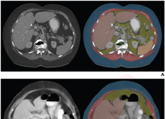 Technical adequacy of artificial intelligence body composition assessed in external CT