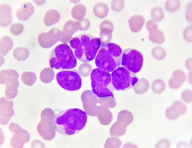 AI-assisted analysis helps find new targets for CAR-T cell therapy ...