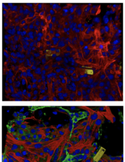Cyborgs Monitor the Functional Maturation of Stem-Cell Derived Heart Tissue