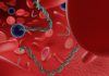 Biotech firm Gene Solutions: A promising picture for multi-cancer early detection in Southeast Asia