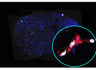 Study of cerebral blood vessels uncovers potential new drug targets for treating stroke