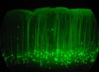 High-resolution atlas illustrates the development of human retina