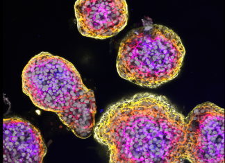 New insights into liver cancer using organoids