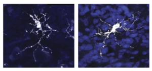 Organoid Model Allows Study of Microglia in Human-Derived Tissue