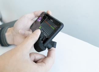 Super low-cost smartphone attachment brings blood pressure monitoring to your fingertips