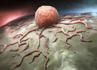 3D models of ovarian cancer reveal how cell’s location can affect tumor biology