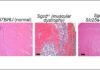 Mitochondrial Membrane Pore Implicated in Muscular Dystrophy Cell Death Mechanism