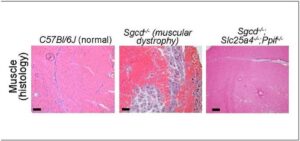 Mitochondrial Membrane Pore Implicated in Muscular Dystrophy Cell Death Mechanism
