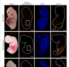 In a First, Solid Humanized Kidneys Grown Inside Pigs