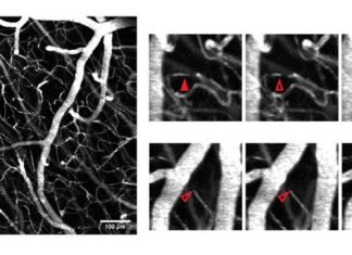 New method for detecting blood circulation problems in brain capillaries
