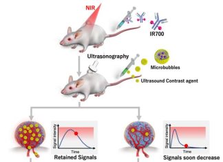 A new NIR-PIT biomarker paves the way for targeted cancer treatments