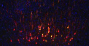 Gene Expression Pattern Predicts Which Neurons Will Regenerate after Injury