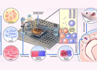 3D-Bioprinted Implants Show Promise in Model of Severe Brain Injury
