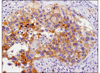AmoyDx and CST Expand Existing Partnership for the Development of Companion Diagnostics (CDx) to Support Precision Oncology