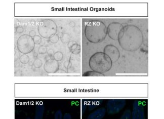 Decoding cell fate: Key mechanism in stem cell switch identified