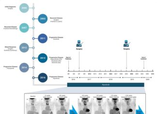 Management of recurrent gastrointestinal cancer with ripretinib and surgery