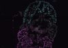 Multi-Chambered Heart Organoids Allow Study of Organ Development and Defects